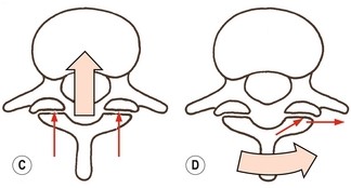 facettes articulaires T.jpg