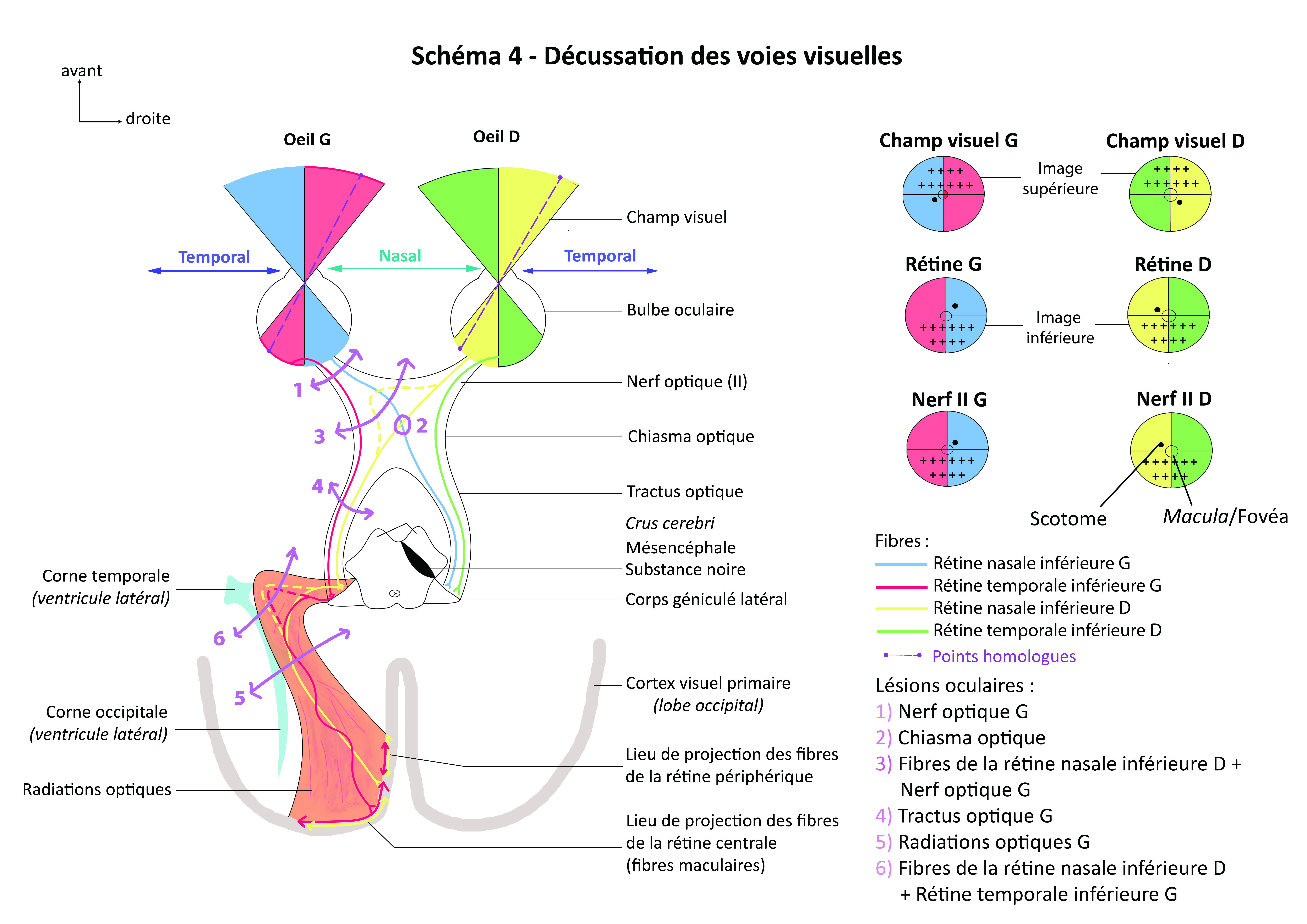 schéma 4 - Décussation des voies visuelles def.jpg