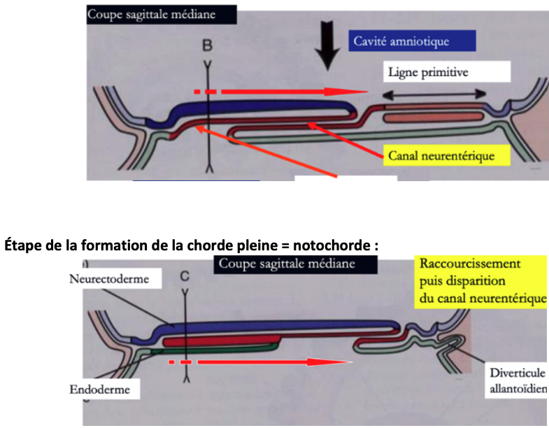Plaque chordale x chorde pleine.png