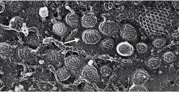 Cavéoline cryofracture.png