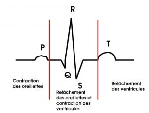 Complexe QRS.jpg