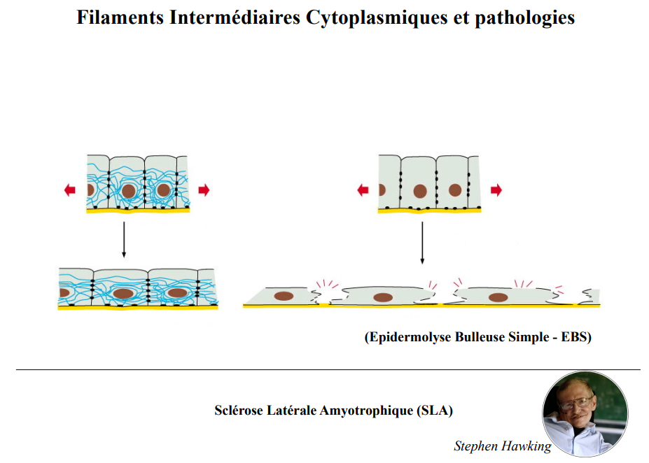 Épidermolyse bulleuse simple - BIOCELL.png