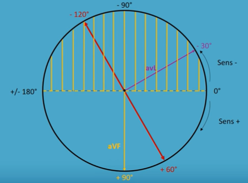 QRS2.PNG