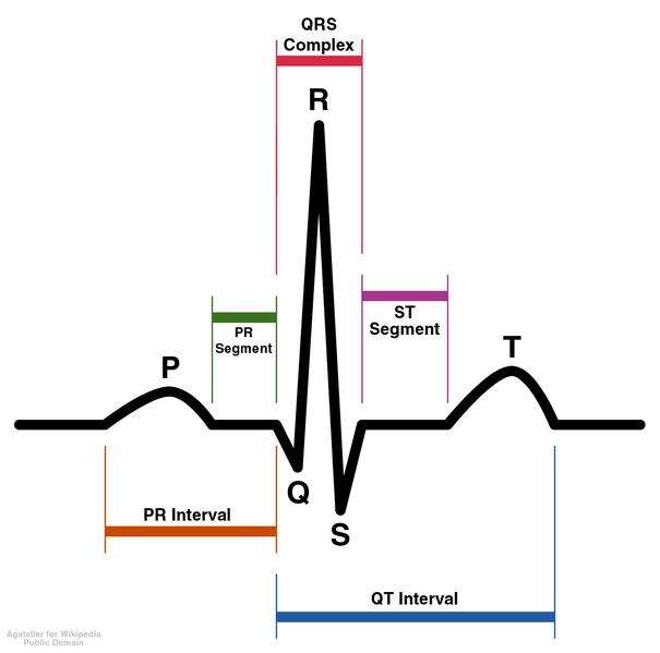 d3169b52d7_50034494_electrocardiogramme-agateller-anthony-atkielski-wiki-dp.jpg